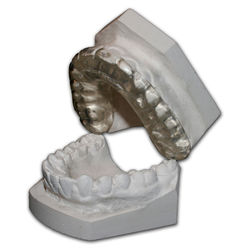 Michigan-Splint-open